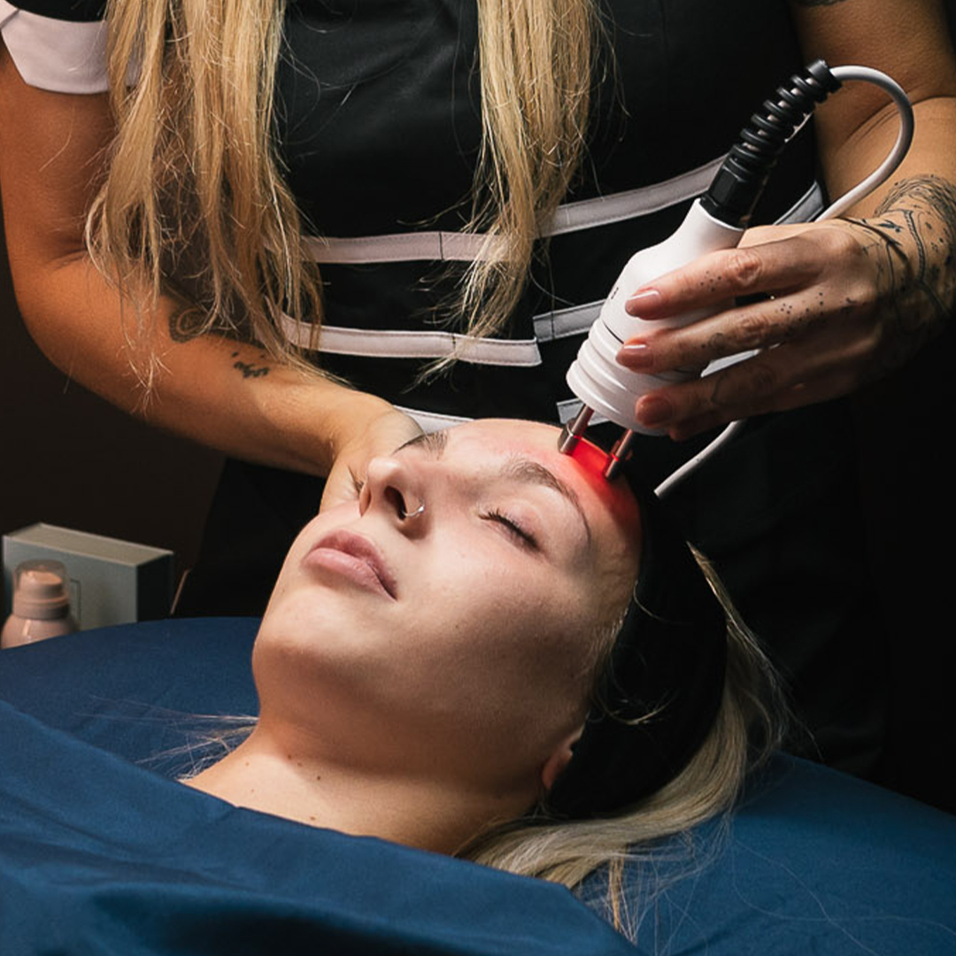 Pathos microneedling 03